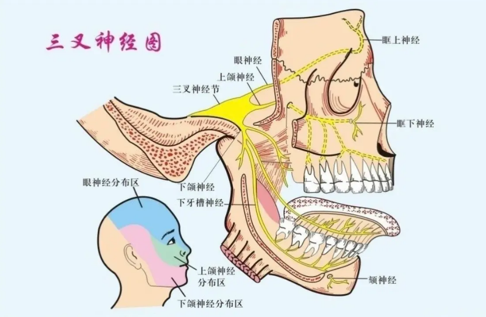 得了三叉神经痛怎么治疗?