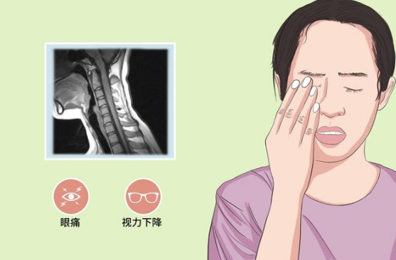 视神经损伤应该如何治疗?