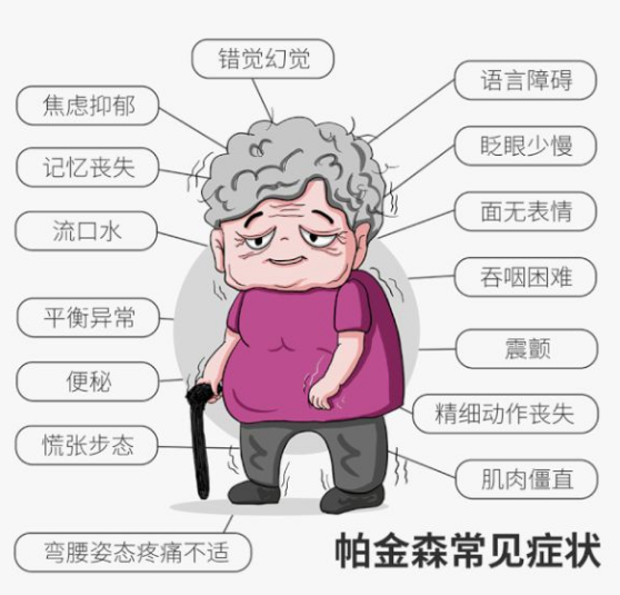 帕金森综合征的治疗方法