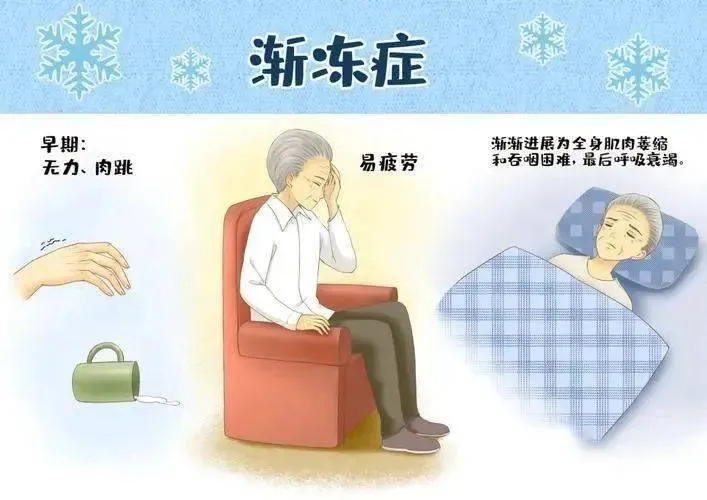 6.21世界渐冻人日丨一个被