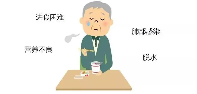 脑卒中患者吞咽困难该吃哪些食物?饮食有哪些策略?