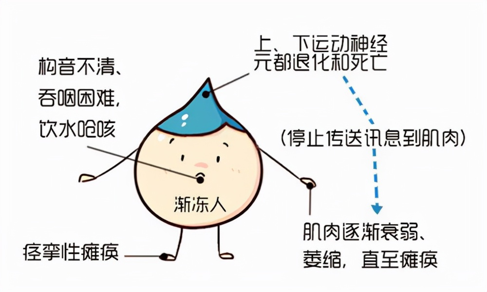 运动神经元病患者肌肉萎缩无力怎么办?