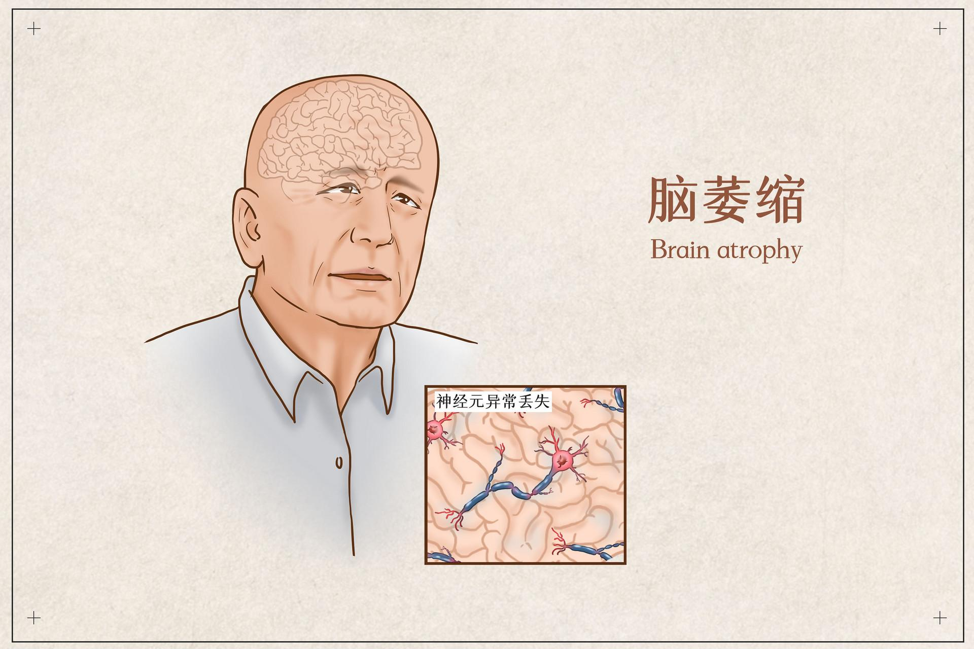 28b844e45f8740c3b6e65930535a3243.png