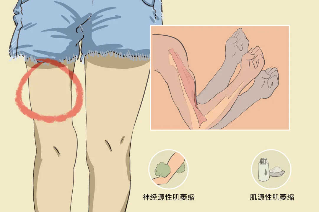 脑梗后遗症应对：提升全身力量的康复策略