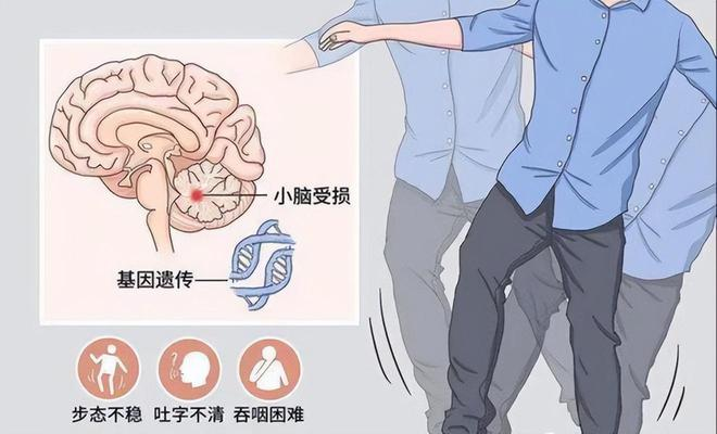 如何缓解共济失调患者走路不稳、进食呛咳问题?