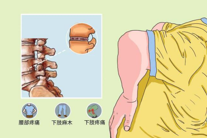 脊髓炎患者在饮食方面要注意什么?