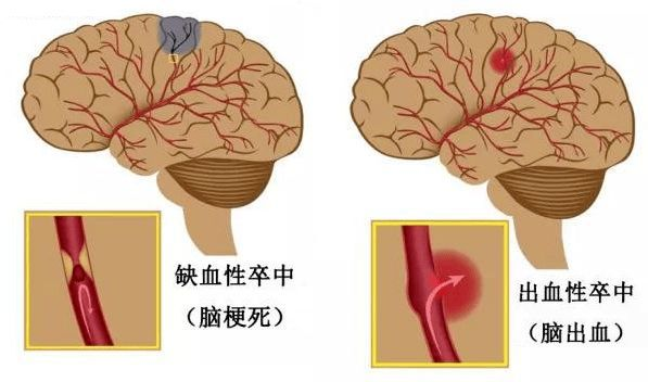 28b844e45f8740c3b6e65930535a3243.png