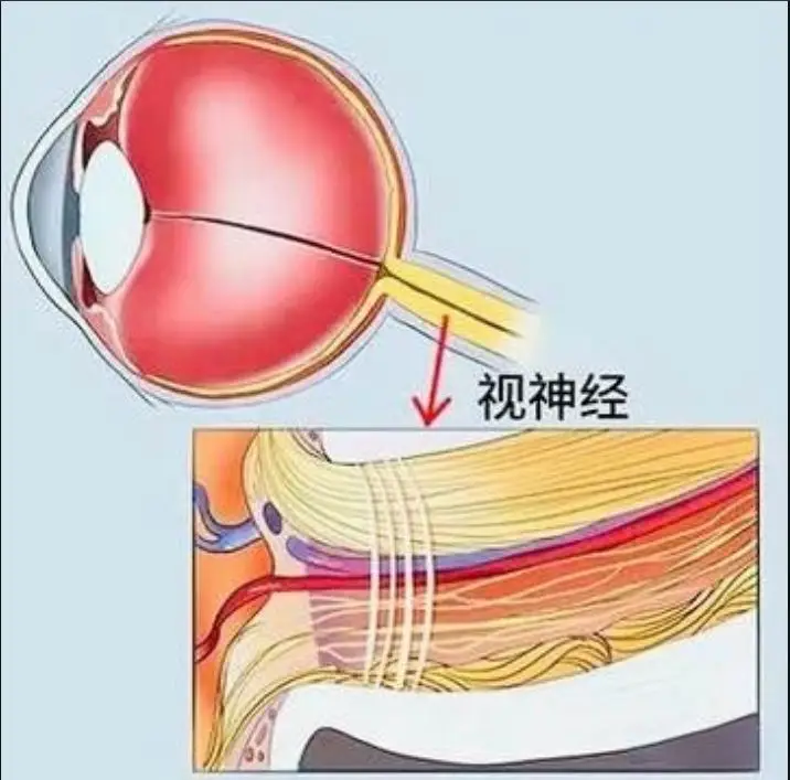 视神经萎缩的隐形威胁：不及时治疗，多久会失明？