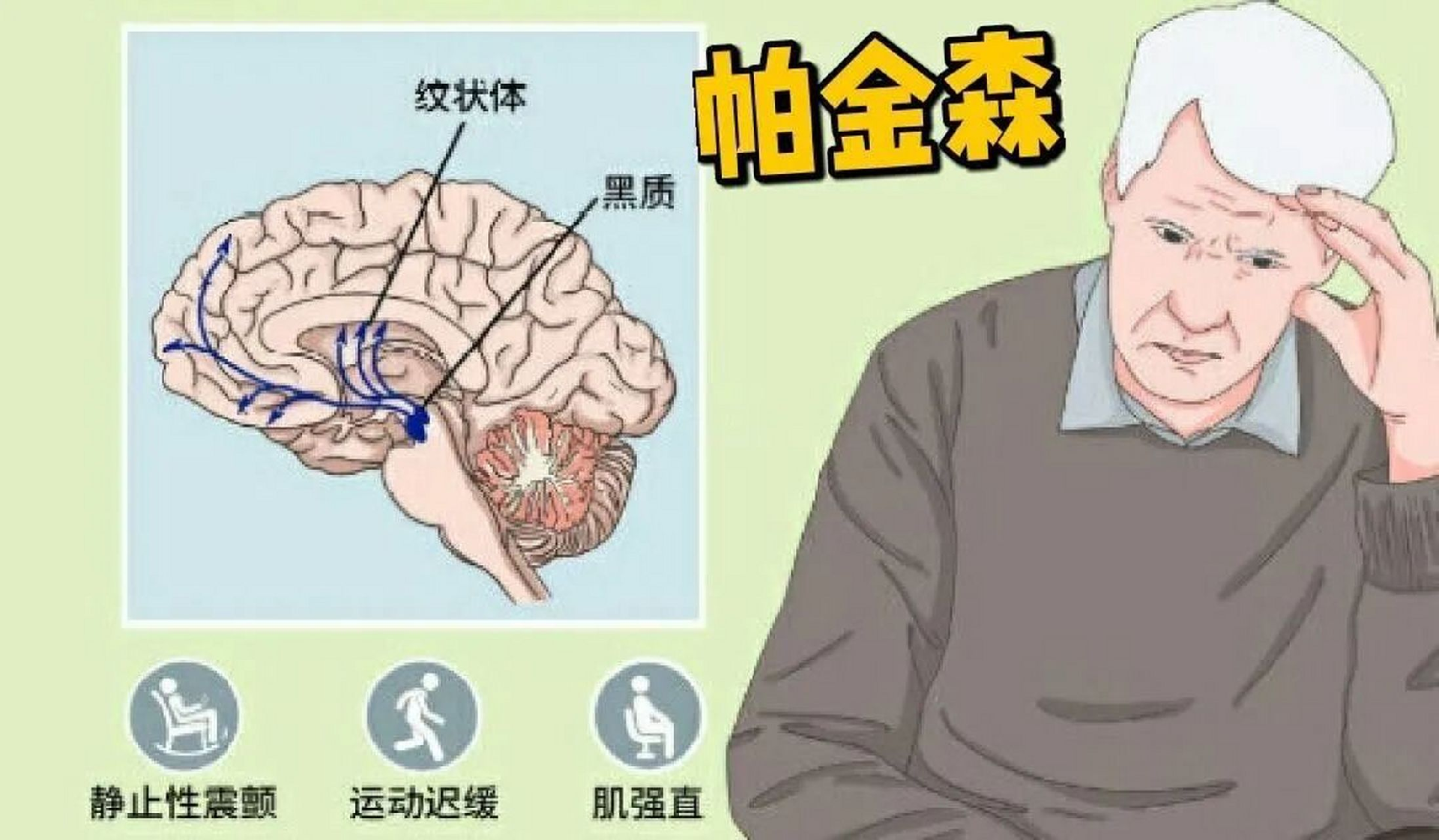 帕金森后期最严重的症状表现有哪些？
