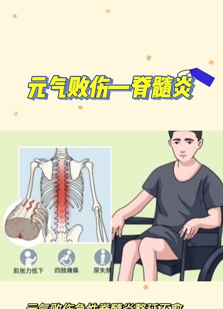 警惕!脊髓炎高危人群:这些因素可能诱发疾病
