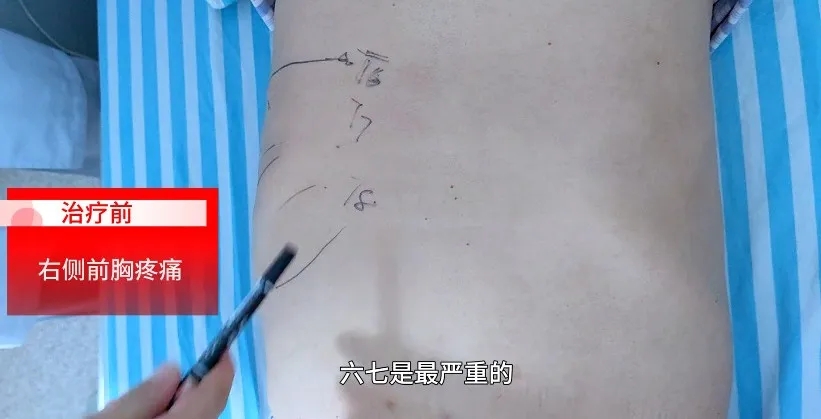 【案例纪实】一面锦旗一份肯定:精湛医术,助糖尿病周围神经病变患者解除痛苦