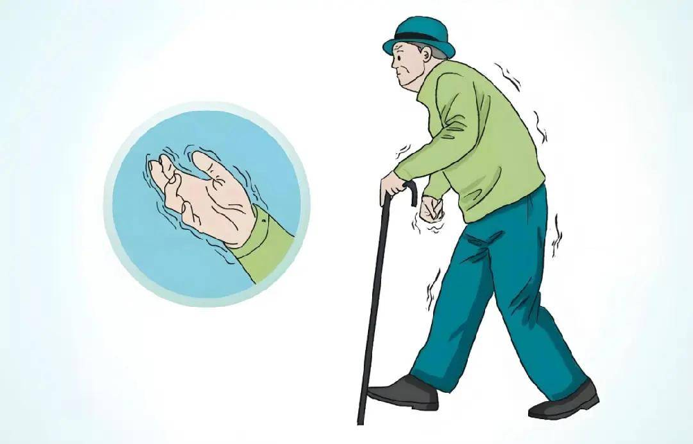 帕金森手抖患者必看!5个日常锻炼动作,轻松缓解震颤
