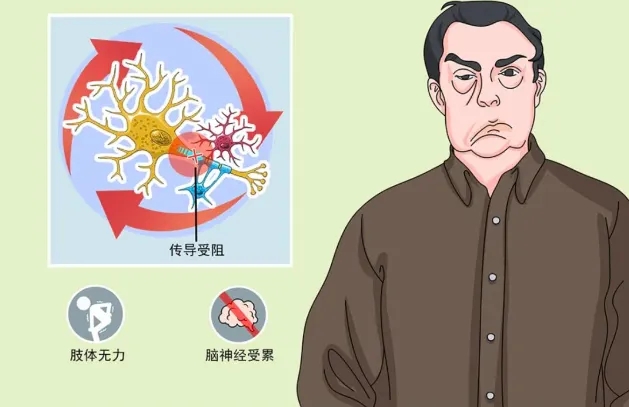 【案例纪实】格林巴利综合征突袭致四肢瘫痪：神经修复显效，从无法翻身到自主坐立|广州治疗格林巴利多久能恢复