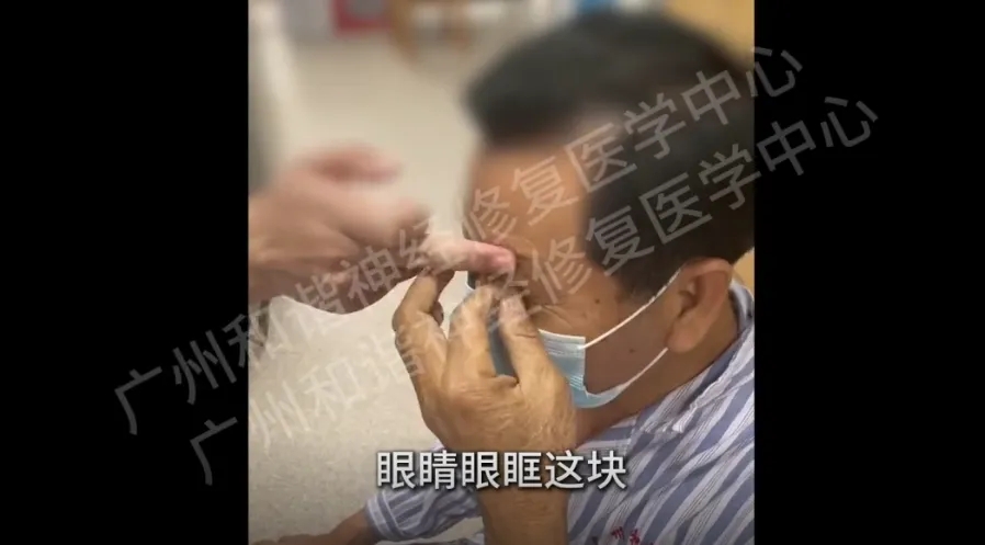 【案例纪实】六年带状疱疹痛如 “精神酷刑”!发作时痛不欲生,微创技术一针终结剧痛,助他回归正常生活!广州带状疱疹能自愈吗?