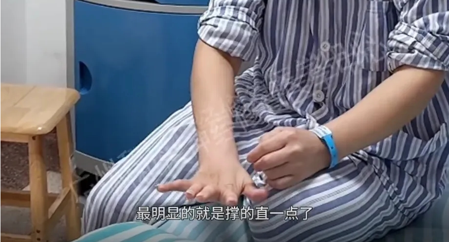 【查房日记】虎口深陷如沟、手指蜷曲 !确诊渐冻症后,神经修复助蜷曲手指奇迹般伸直|广州渐冻症能看好吗?