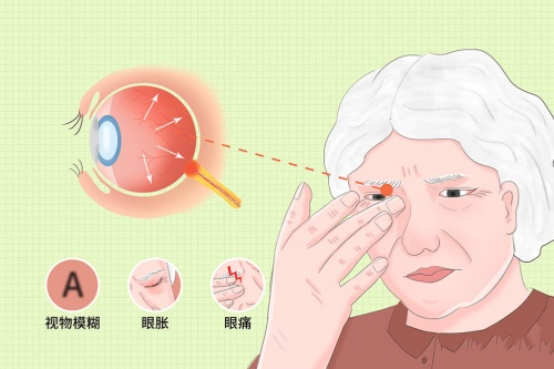 视神经萎缩的日常护眼指南,守护你的“心灵之窗”