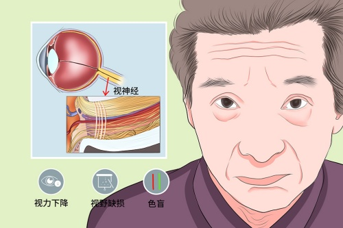 视神经萎缩到失明需要多久?答案藏在“时间轴”里的关键细节里