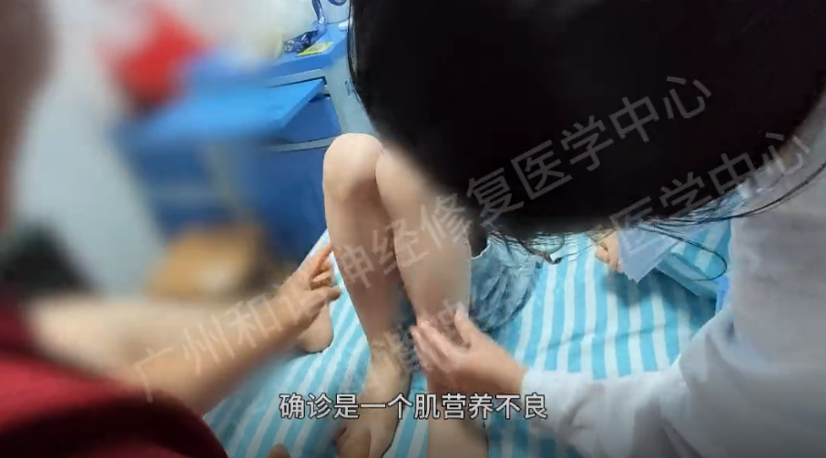 【纪实案例】肌营养不良患儿的曙光：神经修复破无力之茧，肌力渐强焕新生|广州肌营养不良去哪里医院治疗好