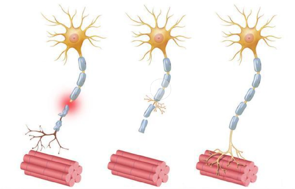 神经损伤后，多久才能恢复？