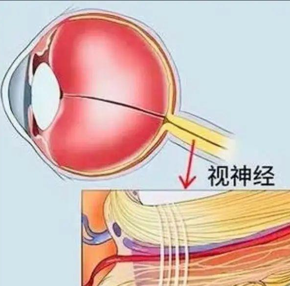 出现2项以上这种症状需警惕视神经萎缩,早发现能保视力