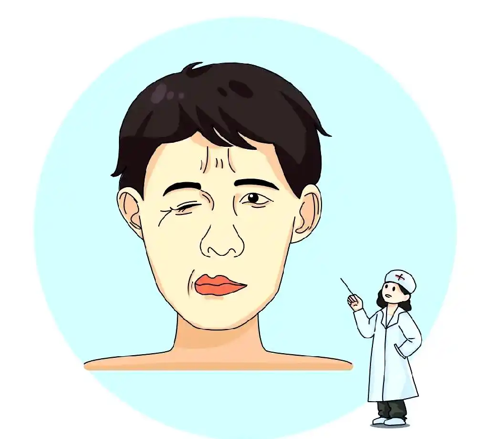 面肌痉挛千万别做！这5个禁忌动作，越做抽得越厉害