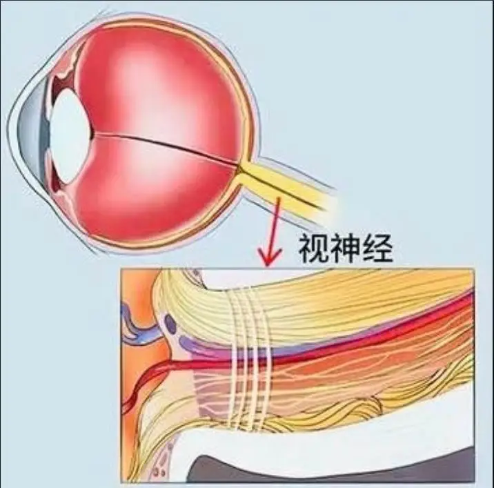 视神经萎缩会快速失明吗?3个信号判断病情进展快慢!个性化对症治疗守住光明