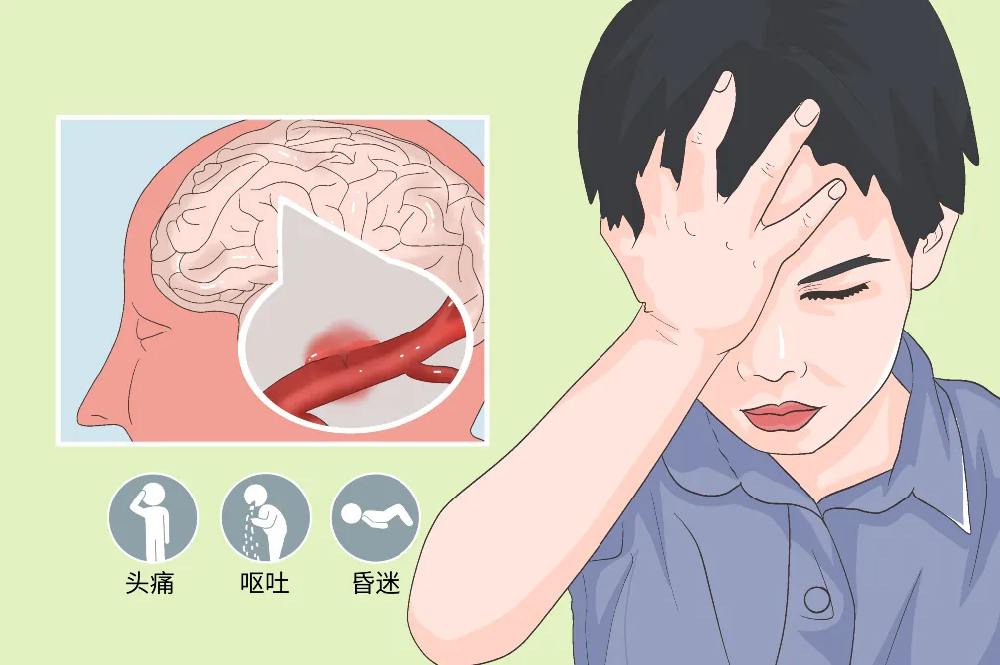 脑梗、脑出血后恢复快?对照看看你是否属于这3类情况