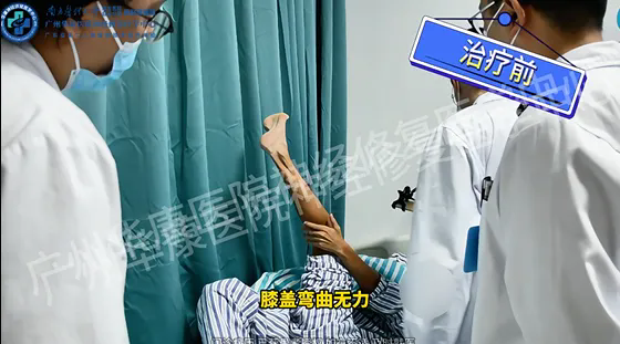 【案例实录】从“不敢走路”到“重新迈步”：一位腓骨肌萎缩症男孩的神经修复治疗实录