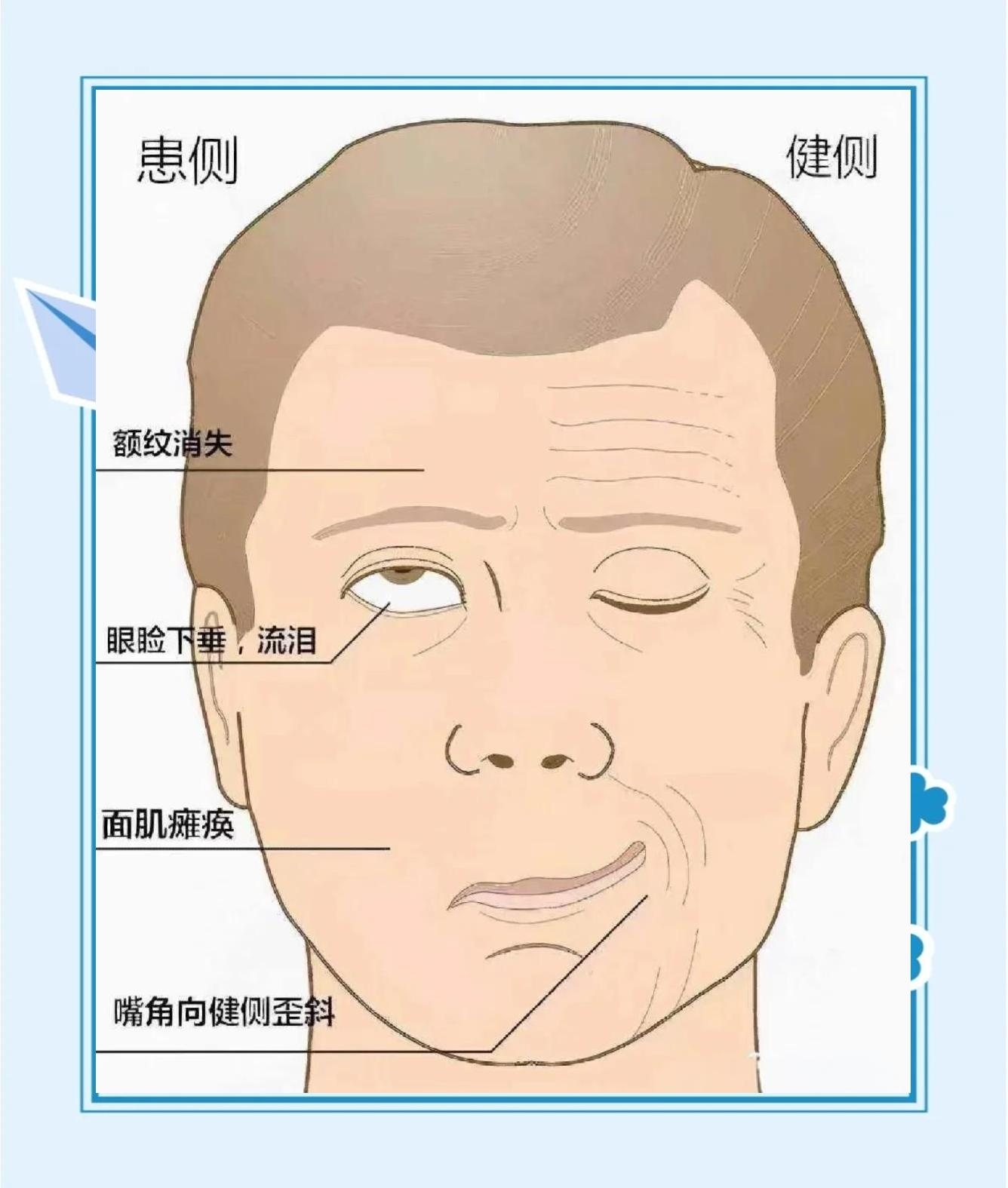 j.png