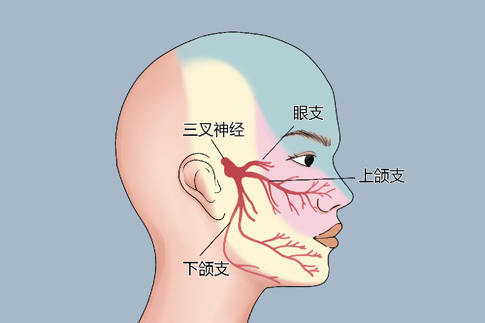 吃饭洗脸都刺痛?三叉神经痛日常避坑护理技巧