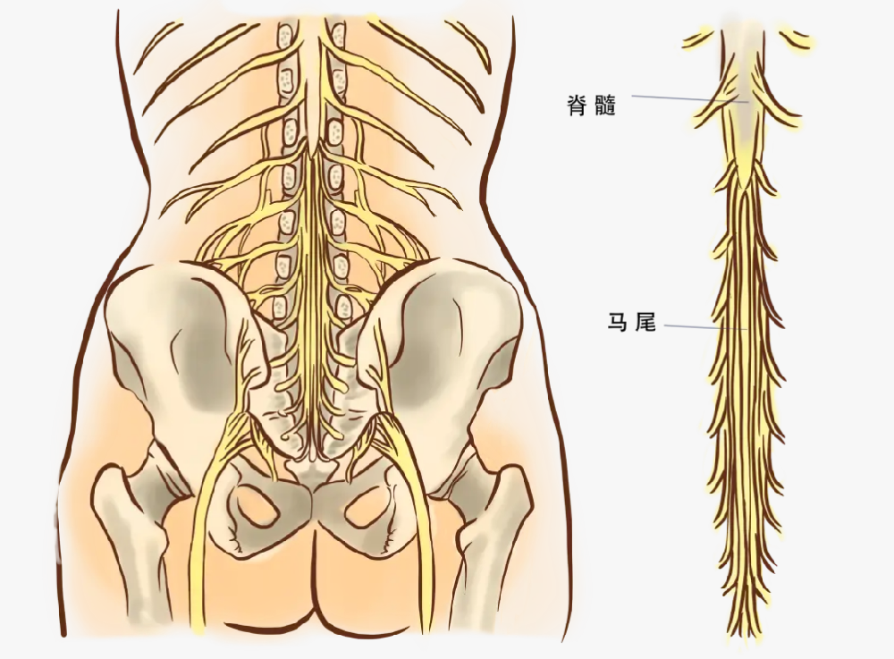 加重神经炎症、腰反复痛！马尾患者少吃这几种食物